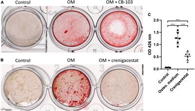 Crenigacestat (LY3039478) inhibits osteogenic differentiation of human valve interstitial cells from patients with aortic valve calcification in vitro